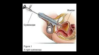 Cystoscopy!!! Cystoscope!! Dr Gohar Shahroz #short #medical #doctor #baby