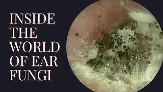Inside The World of EAR FUNGI