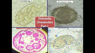 Helminths (Nematodes) Part- 1 Round Worm