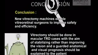 Vitreous Surgery Management of Tractional Retinal Detachment Part2