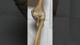 Elbow Joint