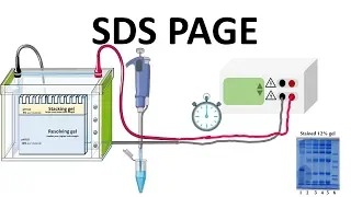 SDS PAGE : How does it works?