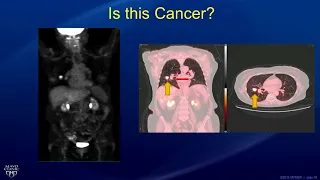 Molecular Imaging for the Detection of Cancer