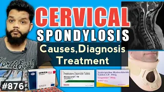 Cervical Spondylosis In Hindi | Cervical Spondylosis Treatment