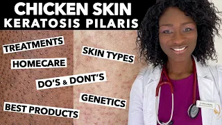 Keratosis Pilaris, Chicken Skin - Treating Dry Bumpy Skin | Special Tips for Black Skin | Ask Doctor