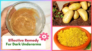 Easy DIY Effective Home Remedy For Dark Underarms and Inner Thighs - #Shorts