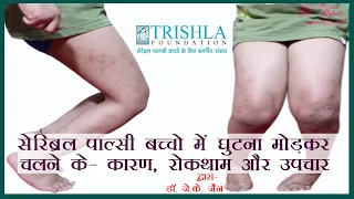 Why Cerebral palsy child walk with bend knee: सेरेब्रल पाल्सी के बच्चे घुटने मोड़ कर क्यों चलते है ?