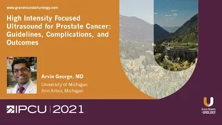 High Intensity Focused Ultrasound for Prostate Cancer: Guidelines, Complications, and Outcomes