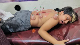 Ye kya ho gaya Ali ko  😳|| Ali ka hijama ||