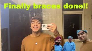 Finally Braces Lag Gaye |Daily Vlog :  579