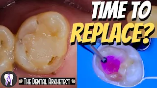 MESMERIZING Restoration of A Big Leaky Old Tooth Filling Using Electric Handpiece #4k #C32