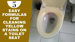 5 Easy Formulas for Cleaning Yellow Stains on a Toilet Seat