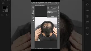 How to remove hair fall gap in photoshop 2024 | Fill Hair & Eyebrows in Photoshop