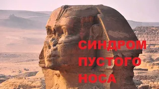 Синдром пустого носа. Садыхов Р.А.