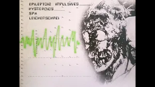 SPK - Genetic Transmission/Post-Mortem