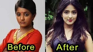 Dark Skin Tv Actress Before & After | Unbelievable Transformation