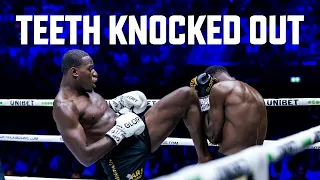 Teeth Knocked Out | Michael Boapeah vs Ulric Bokeme | GLORY Collision 5 | @glory