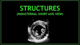Cardiac STRUCTURES! - Echocardiography (Parasternal short axis view)
