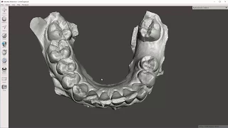 Video 1 of 5: MeshMixer - Dental Model Cleanup