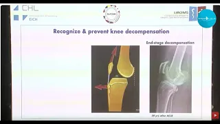 New evolutions in ACL injuries - Prof Romain Seil – Visiting Orthopaedic Surgeon, Aspetar