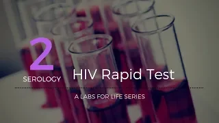 HIV Rapid Test