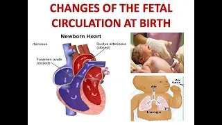 CHANGES OF THE FETAL CIRCULATION AT BIRTH