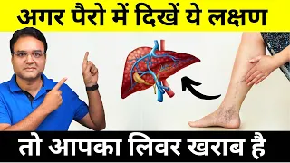 Never Ignore These 9 Warning Signs Of Liver Disease That Come In Your Feet | Healthy Hamesha