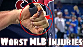 MLB | Interesting Injuries 2