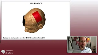 The technology and science of how tDCS boosts brain capacity and can enhance recovery after injury.