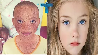 TOP 10 AMAZING AND UNIQUE CHILDREN WHO ARE 1% OF THE WORLD