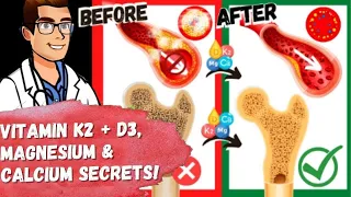 Vitamin K2 & Vitamin D3 NEW SECRETS! [+ Magnesium & Calcium MISTAKES]