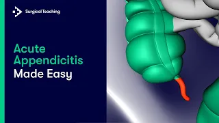 Appendicitis Made Easy : A Complete Revision Guide