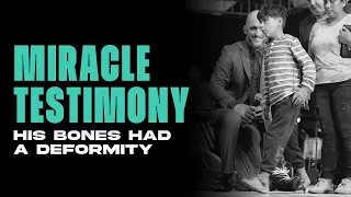 His Bones Had A Deformity  | #Testimony | Nathan Morris