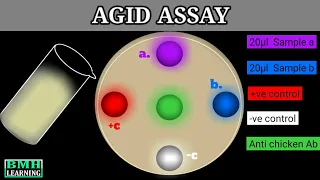 Agar Gel Immunodiffusion Assay | AGID Assay |