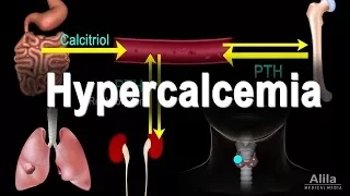 Hypercalcemia - Too Much Calcium, Animation
