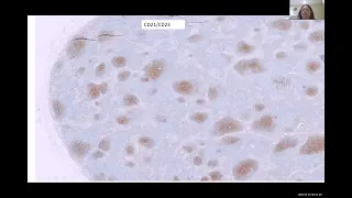 Lymph Node Histology : Dr  Tanuja Shet