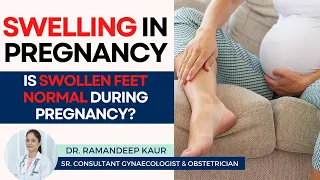 Swelling in Pregnancy | Swollen legs & Feet | What's Normal & When to Worry | Healing Hospital