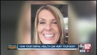 How poor oral health affects the rest of you