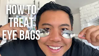 How to get rid of UNDER EYE BAGS FAST (the SAFEST ways) | 👁 Ophthalmologist @michaelchuamd