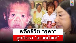 ครั้งแรกของไทย ศัลยกรรมพลิกชีวิต "ยุพา" สาวป่วยโรคชรา | สถานการณ์ | 27 พ.ค. 67 | ข่าวช่อง8