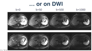 4 Contrast Agents Part I