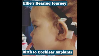 Ellie's Hearing History-Birth to Cochlear Implants
