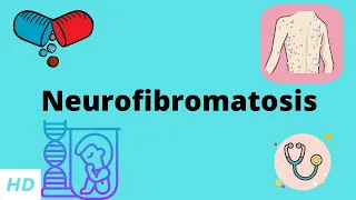 Neurofibromatosis, Causes, Signs and Symptoms, Diagnosis and Treatment.