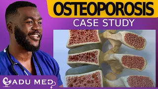 Osteoporosis case study | Background and Assessment| Pass the MRCGP AKT