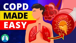 COPD Explained - Types, Causes, Symptoms, and Treatment ❗