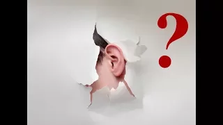 ОТТОПЫРЕННЫЕ уши? (тест на необходимость операции)
