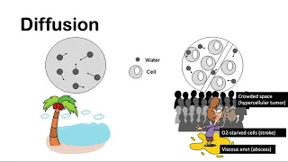 Diffusion weighted imaging (1/4)- DWI, ADC & b-values simplified