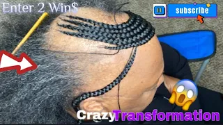 Any Alopecia style can be achieved JUST WATCH THIS😱😱😱