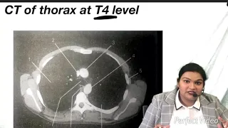 CT Of Thorax at T4 level- CT scan of Thorax by Rao medical academy