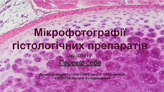 Мікрофотографії гістологічних препаратів. Перевір себе.